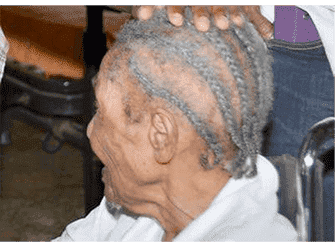 Ageing Trends In Barbados